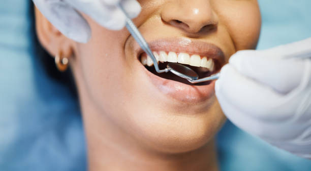 Best Dentist for Dental Trauma  in Church Hill, TN