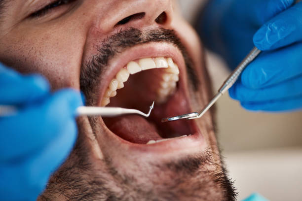 Best Dentist for Tooth Abscess  in Church Hill, TN